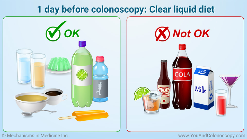 what-is-a-colonoscopy-and-how-do-i-prepare-for-it