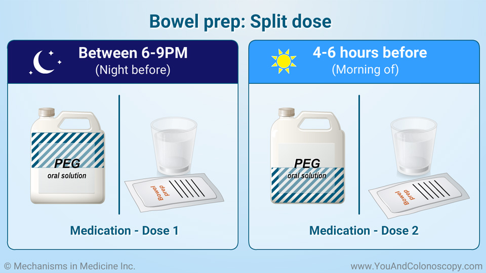 What is a colonoscopy and how do I prepare for it?
