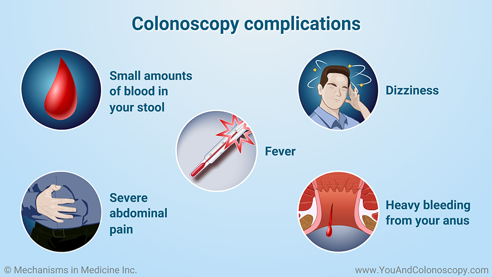 What happens during and after a colonoscopy?