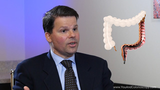 What is a flexible sigmoidoscopy?