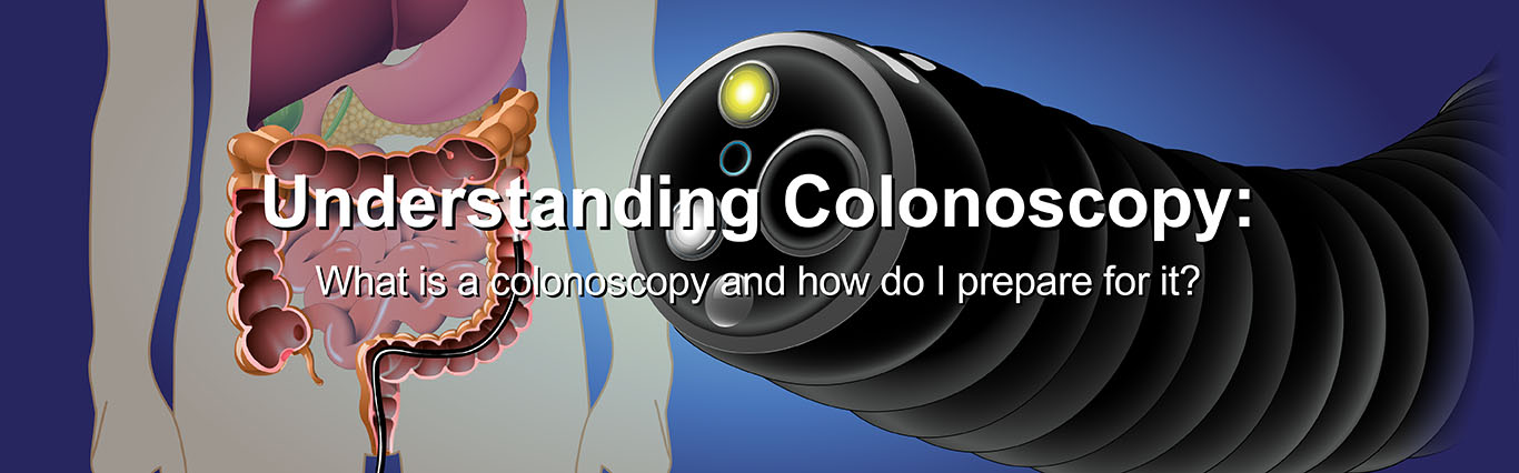 Understanding Colonoscopy: What is a Colonoscopy and How Do I Prepare for It?. WATCH NOW