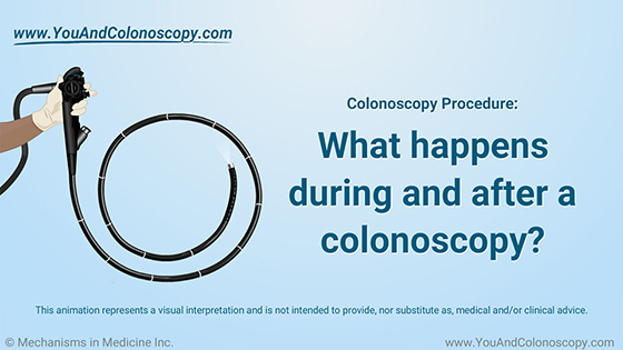 During and After Colonoscopy