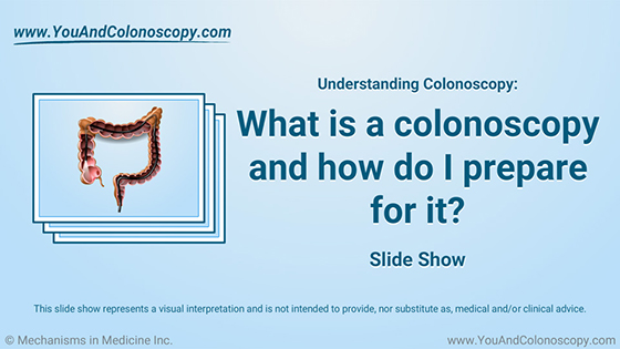 Slide Show - What is a colonoscopy and how do I prepare?